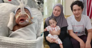 Read more about the article Help Baby AFFAN Breathe and Live