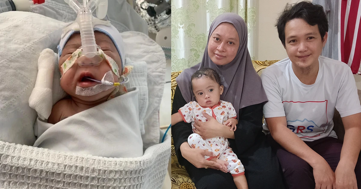 Read more about the article Help Baby AFFAN Breathe and Live