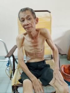 Read more about the article A 70-year-old man diagnosed with pancreatic cancer urgently needs surgery to save his life