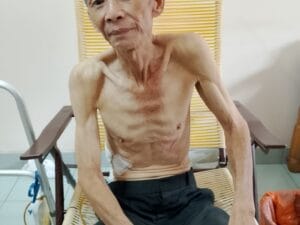 A 70-year-old man diagnosed with pancreatic cancer urgently needs surgery to save his life
